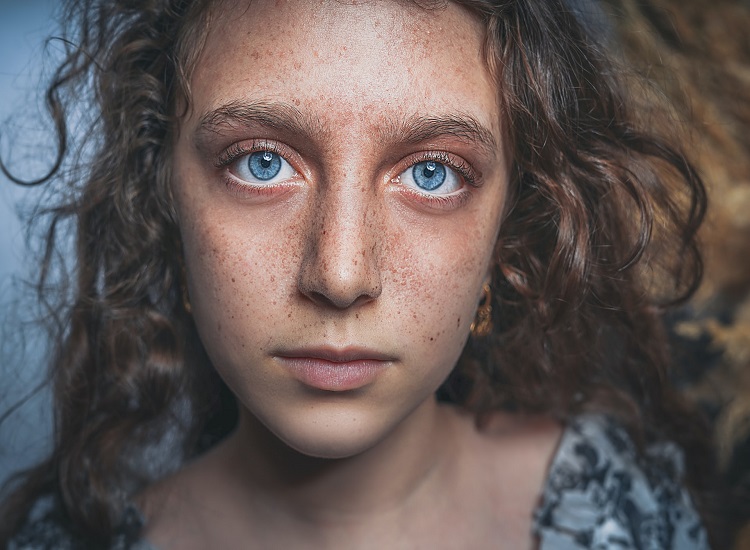 Skin Disorder Reasons